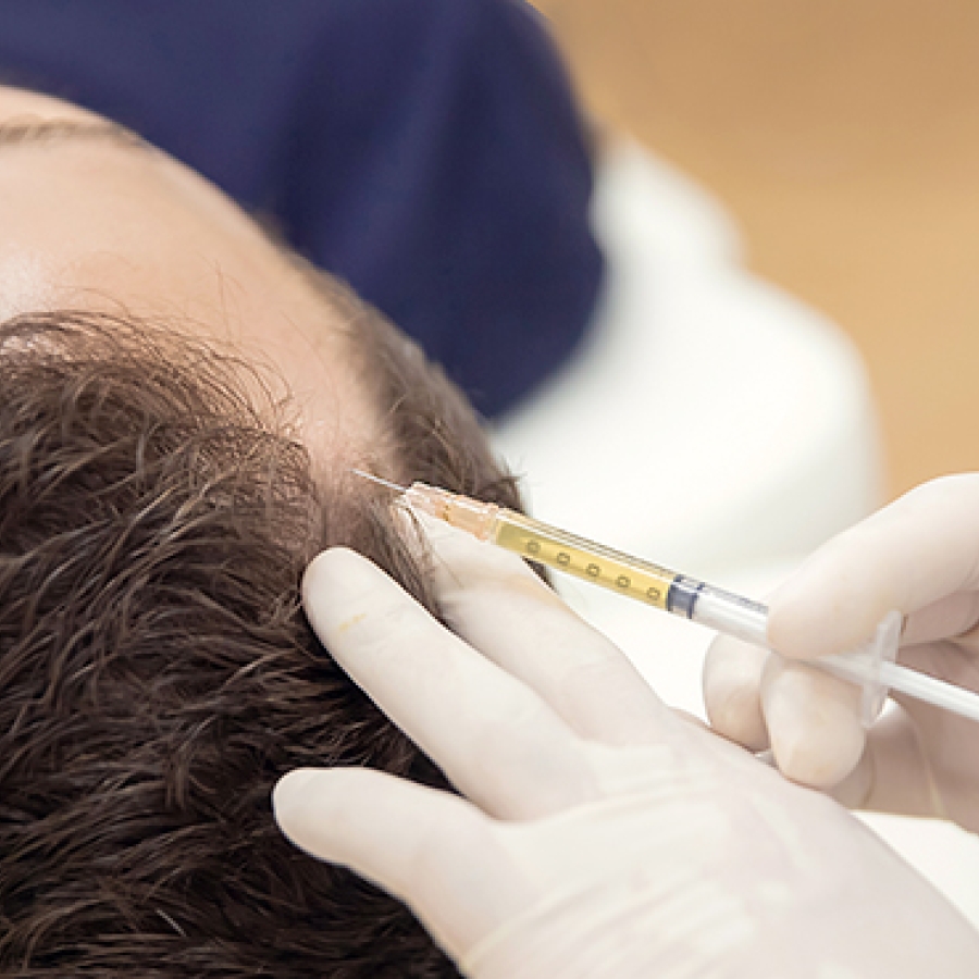 Mesotherapy for Hair Growth | Dr Sunil Mishra