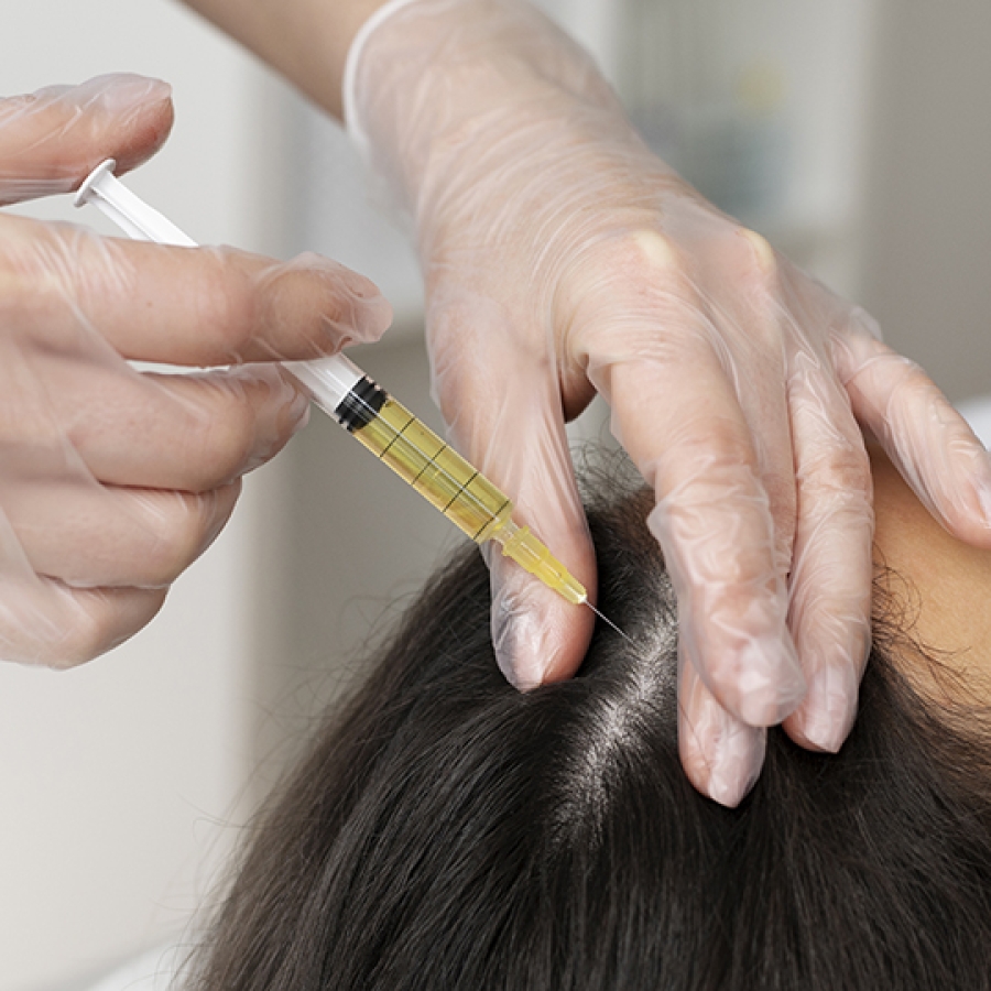 PRP Treatment For Hair Loss Cost And Success Rate In India  2022