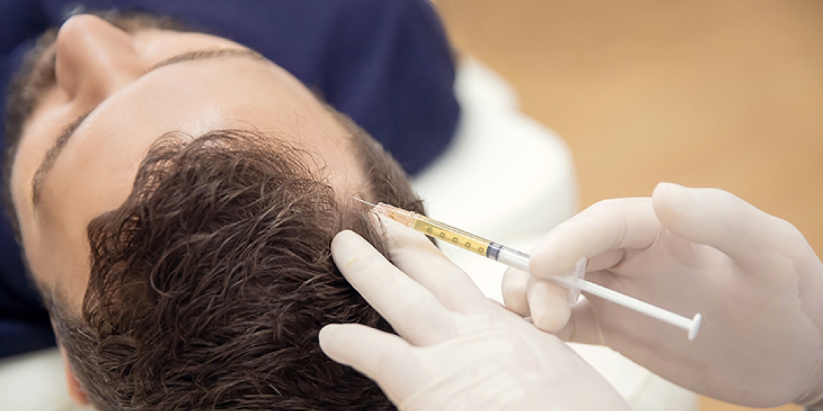 Growth Factor Concentrate Therapy (GFC) | Dr Sunil Mishra Growth Factor Concentrate Therapy (GFC) | Dr Sunil Mishra