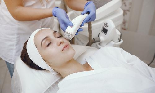 Laser Acne Scar
