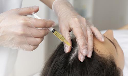 Platelet Rich Plasma (PRP treatment)